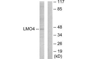Western blot analysis of extracts from 293 cells, using LMO4 antibody. (LMO4 antibody  (C-Term))