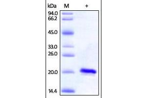 Human SOD1, His Tag on SDS-PAGE under reducing (R) condition. (SOD1 Protein (AA 2-154) (His tag))