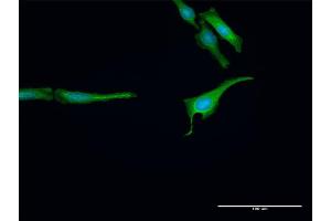 Immunofluorescence of purified MaxPab antibody to RNF14 on HeLa cell. (RNF14 antibody  (AA 1-348))
