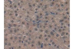 Immunohistochemistry (IHC) image for anti-Hypoxanthine phosphoribosyltransferase 1 (HPRT1) (AA 3-218) antibody (ABIN7432454)