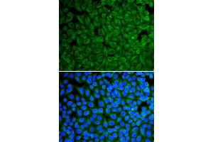 Immunofluorescence analysis of A549 cell using GAD2 antibody. (GAD65 antibody  (AA 401-585))