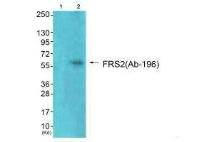 Western blot analysis of extracts from 293 cells (Lane 2), using FRS2 (Ab-196) antiobdy. (FRS2 antibody  (Tyr196))