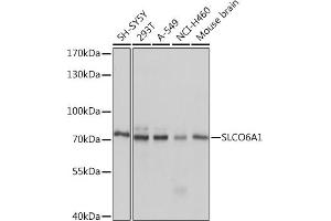 Western blot analysis of extracts of various cell lines, using SLCO6 Rabbit pAb (4963) at 1:1000 dilution. (SLCO6A1 antibody  (AA 480-580))