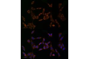 Immunofluorescence analysis of NIH/3T3 cells using MDK Rabbit pAb (ABIN3020790, ABIN3020791, ABIN3020792 and ABIN6213725) at dilution of 1:25 (40x lens). (Midkine antibody  (AA 21-143))