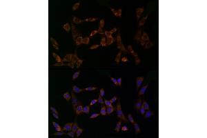 Immunofluorescence analysis of NIH/3T3 cells using MDK Rabbit pAb (ABIN3020790, ABIN3020791, ABIN3020792 and ABIN6213725) at dilution of 1:25 (40x lens). (Midkine antibody  (AA 21-143))