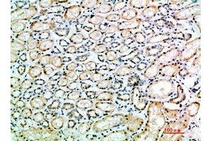 Immunohistochemical analysis of paraffin-embedded human-kidney, antibody was diluted at 1:200 (Angiotensin I Converting Enzyme 1 antibody  (AA 41-90))