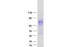 Validation with Western Blot (ANTXR1 Protein (Transcript Variant 2) (Myc-DYKDDDDK Tag))
