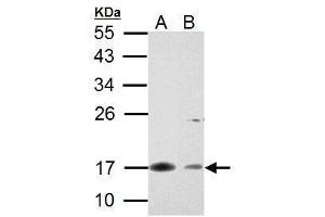 WB Image Survivin antibody detects Survivin protein by Western blot analysis.