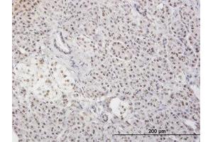 Image no. 3 for anti-Myeloid Leukemia Factor 2 (MLF2) (AA 1-249) antibody (ABIN599027) (MLF2 antibody  (AA 1-249))
