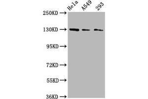 Western Blot Positive WB detected in: Hela whole cell lysate, A549 whole cell lysate, 293 whole cell lysate All lanes: SEMA6D antibody at 3 μg/mL Secondary Goat polyclonal to rabbit IgG at 1/50000 dilution Predicted band size: 120, 114, 112, 116, 118, 55, 68 kDa Observed band size: 130 kDa (SEMA6D antibody  (AA 913-1068))