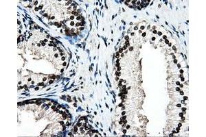 Immunohistochemical staining of paraffin-embedded colon tissue using anti-PSMC3mouse monoclonal antibody. (PSMC3 antibody)
