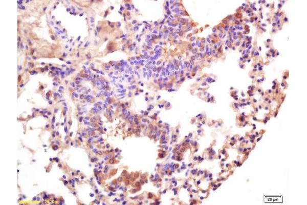 CECR5 antibody  (AA 251-350)