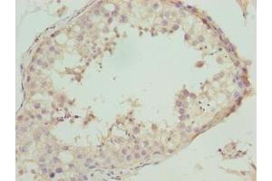 Immunohistochemistry of paraffin-embedded human testis tissue using ABIN7161250 at dilution of 1:100 (NBPF3 antibody  (AA 1-252))