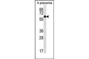 Western blot analysis of LCCI1 Antibody (Center) in human placenta tissue lysates (35ug/lane). (GLCCI1 antibody  (Middle Region))
