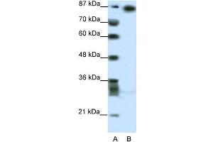 Human HepG2; WB Suggested Anti-MYNN Antibody Titration: 2. (Myoneurin antibody  (Middle Region))