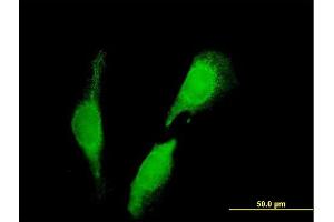 Immunofluorescence of purified MaxPab antibody to SEC23IP on HeLa cell. (SEC23IP antibody  (AA 1-486))