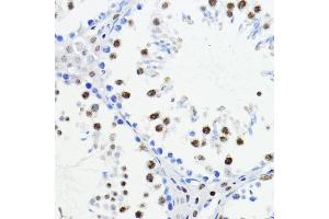 Immunohistochemistry of paraffin-embedded mouse testis using ZEB1 antibody (ABIN6129933, ABIN6150422, ABIN6150423 and ABIN6221237) at dilution of 1:200 (40x lens). (ZEB1 antibody  (AA 1-260))