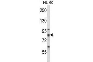 CAPN6 Antibody (Center) western blot analysis in HL-60 cell line lysates (35µg/lane). (Calpain 6 antibody  (Middle Region))