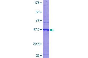 Image no. 1 for Spermidine/Spermine N1-Acetyltransferase 2 (SAT2) (AA 1-170) protein (GST tag) (ABIN1319176) (SAT2 Protein (AA 1-170) (GST tag))