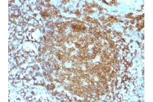 Formalin-fixed, paraffin-embedded human Tonsil stained with CD45RA Mouse Monoclonal Antibody (PTPRC/818). (CD45 antibody)