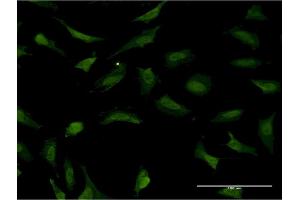 Immunofluorescence of monoclonal antibody to RNF2 on HeLa cell. (RNF2 antibody  (AA 192-290))