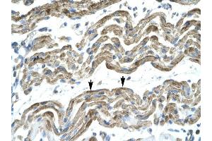 C13ORF8 antibody was used for immunohistochemistry at a concentration of 4-8 ug/ml to stain Skeletal muscle cells (arrows] in Human Muscle. (ZNF828 antibody  (Middle Region))