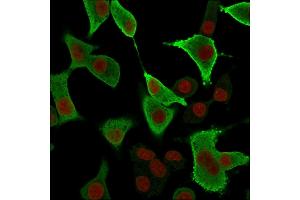 Immunofluorescence (IF) image for anti-Aldo-Keto Reductase Family 1, Member B1 (Aldose Reductase) (AKR1B1) antibody (ABIN6939403)