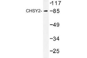 Image no. 1 for anti-Chondroitin Sulfate Synthase 3 (CHSY3) antibody (ABIN317828) (CHSY3 antibody)