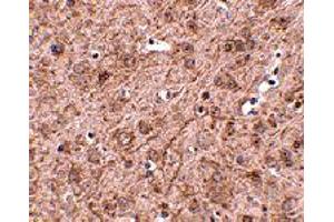 Immunohistochemistry of LASS6 in mouse brain tissue with LASS6 polyclonal antibody  at 2. (CERS6 antibody  (N-Term))