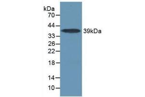 Detection of Recombinant IL17RA, Mouse using Polyclonal Antibody to Interleukin 17 Receptor A (IL17RA) (IL17RA antibody  (AA 590-848))