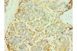 Immunohistochemistry of paraffin-embedded human pancreatic tissue using ABIN7145070 at dilution of 1:100 (COQ8A antibody  (AA 1-220))