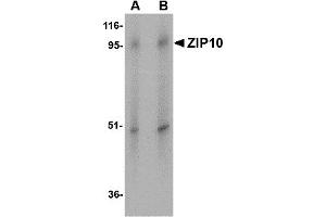 Western Blotting (WB) image for anti-Solute Carrier Family 39 (Zinc Transporter), Member 10 (SLC39A10) (Middle Region) antibody (ABIN1031175)