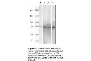 Image no. 2 for anti-RAB25, Member RAS Oncogene Family (RAB25) antibody (ABIN207613) (RAB25 antibody)