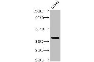 Western Blot Positive WB detected in: Rat liver tissue All lanes: ETV7 antibody at 3 μg/mL Secondary Goat polyclonal to rabbit IgG at 1/50000 dilution Predicted band size: 39, 33, 31, 37, 30, 23 kDa Observed band size: 39 kDa (ETV7 antibody  (AA 134-218))
