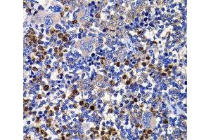 Immunohistochemistry of paraffin-embedded Rat spleen using STAMBP Polyclonal Antibody at dilution of 1:100 (40x lens). (STAMBP antibody)