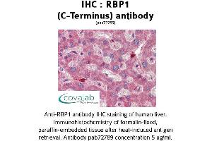 Image no. 2 for anti-Retinol Binding Protein 1, Cellular (RBP1) (C-Term) antibody (ABIN1738770) (RBP1 antibody  (C-Term))