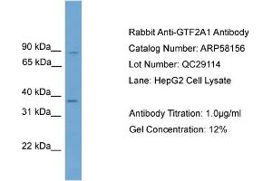 WB Suggested Anti-GTF2A1  Antibody Titration: 0. (GTF2A1 antibody  (Middle Region))
