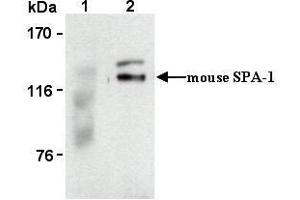 Western Blotting (WB) image for anti-Signal-Induced Proliferation-Associated 1 (SIPA1) antibody (ABIN1449260) (SIPA1 antibody)