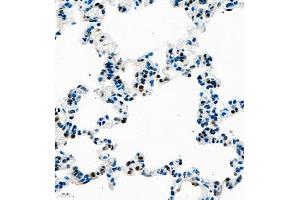 Immunohistochemistry of paraffin embedded rat lung using UBE3A (ABIN7076104) at dilution of 1:1000 (400x lens) (ube3a antibody)