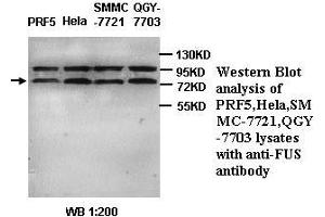 Image no. 1 for anti-Fused in Sarcoma (FUS) (C-Term) antibody (ABIN791042) (FUS antibody  (C-Term))