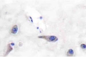 Immunohistochemistry (IHC)analyzes of MARCKS antibody in paraffin-embedded human brain tissue. (MARCKS antibody)