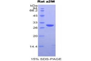 SDS-PAGE (SDS) image for alpha-2-Macroglobulin (A2M) (AA 216-437) protein (His tag) (ABIN2120525)