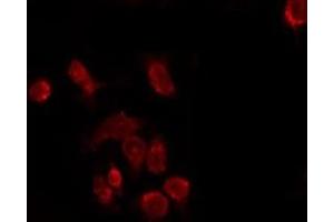 ABIN6277380 staining Hela by IF/ICC. (KISS1R antibody  (C-Term))