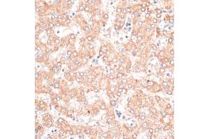 Immunohistochemistry of paraffin-embedded human liver using ABCB7 antibody (ABIN6291732) at dilution of 1:100 (40x lens). (ABCB7 antibody)