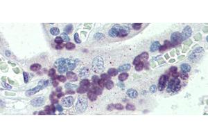 Rabbit Anti-PRDM9 Antibody  arp35967 Paraffin Embedded Tissue: Human Placenta Antibody Concentration: 5 ug/ml