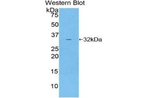 Detection of Recombinant HSP90b1, Human using Polyclonal Antibody to Heat Shock Protein 90 kDa Beta 1 (HSP90b1)