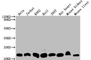 Western Blot Positive WB detected in: Hela whole cell lysate, Jurkat whole cell lysate, K562 whole cell lysate, Raji whole cell lysate, 293T whole cell lysate, Rat heart tissue, Mouse kidney tissue, Mouse liver tissue All lanes: DHFR antibody at 1:2000 Secondary Goat polyclonal to rabbit IgG at 1/50000 dilution Predicted band size: 22, 16 kDa Observed band size: 22 kDa (Recombinant Dihydrofolate Reductase antibody)