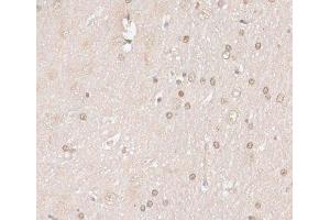 Immunohistochemistry of paraffin-embedded Rat brain using HMGN1 Polyclonal Antibody at dilution of 1:100 (40x lens). (HMGN1 antibody)