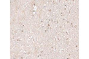 Immunohistochemistry of paraffin-embedded Rat brain using HMGN1 Polyclonal Antibody at dilution of 1:100 (40x lens).