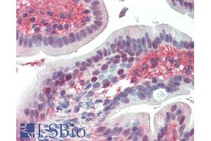 ABIN334389 (3. (EGR2 antibody  (Internal Region))
